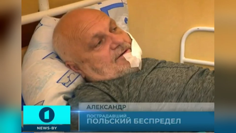 Пострадавший белорус рассказал о том, как получил ранения от польской полиции